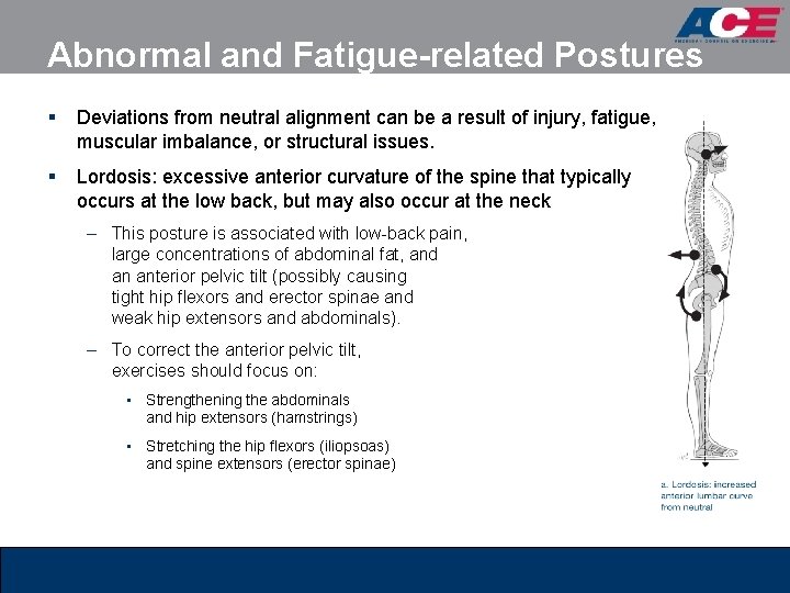 Abnormal and Fatigue-related Postures § Deviations from neutral alignment can be a result of Abnormal and Fatigue-related Postures § Deviations from neutral alignment can be a result of