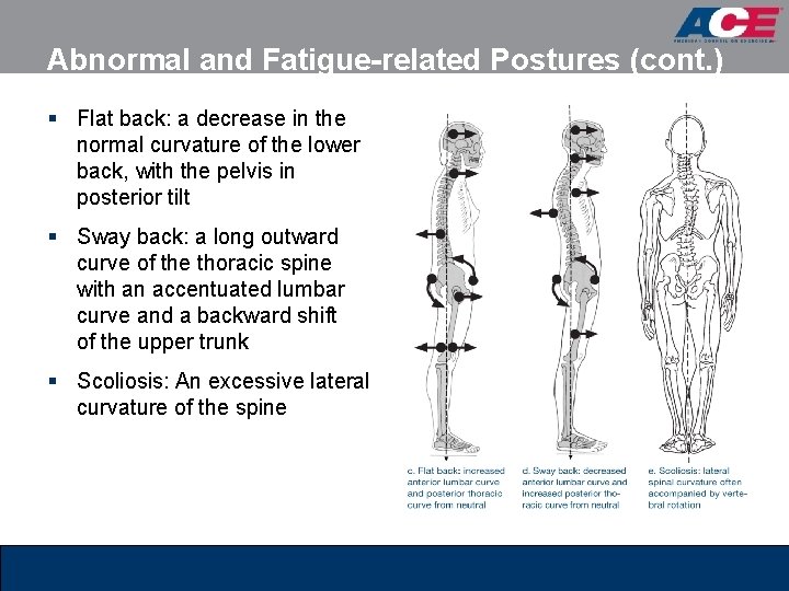 Abnormal and Fatigue-related Postures (cont. ) § Flat back: a decrease in the normal Abnormal and Fatigue-related Postures (cont. ) § Flat back: a decrease in the normal