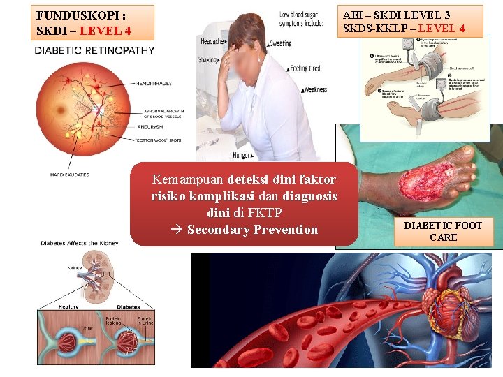 FUNDUSKOPI : SKDI – LEVEL 4 ABI – SKDI LEVEL 3 SKDS-KKLP – LEVEL