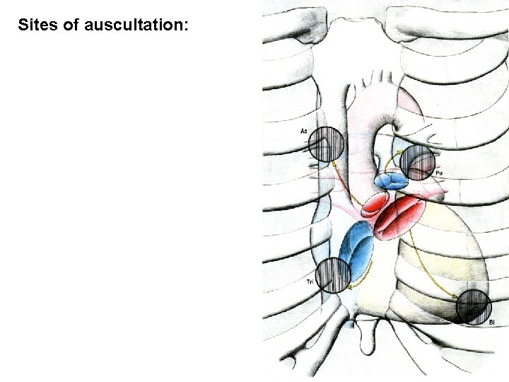 Sites of auscultation: 