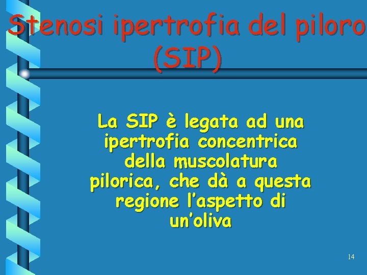 Stenosi ipertrofia del piloro (SIP) La SIP è legata ad una ipertrofia concentrica della