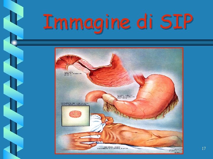 Immagine di SIP 17 