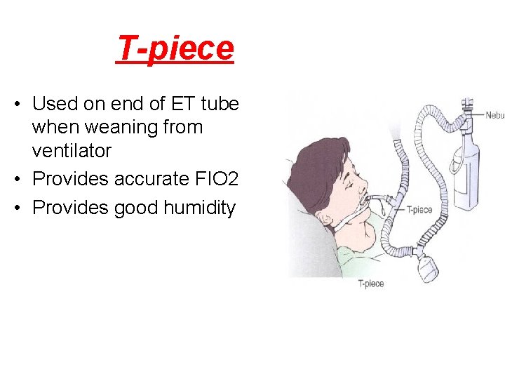 T-piece • Used on end of ET tube when weaning from ventilator • Provides