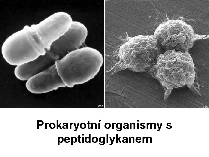Prokaryotní organismy s peptidoglykanem 