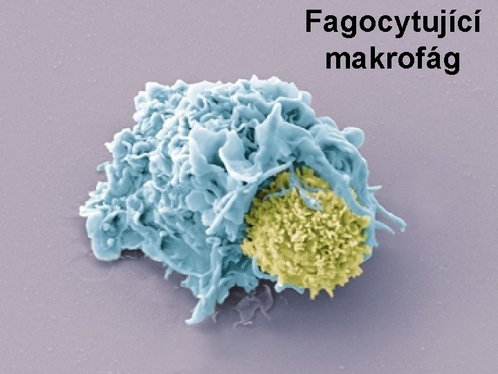 Fagocytující makrofág 