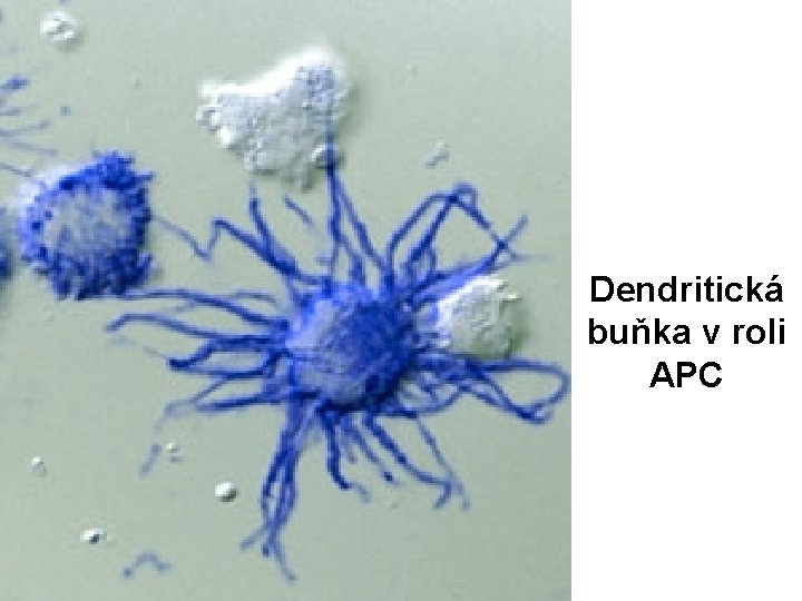 Dendritická buňka v roli APC 