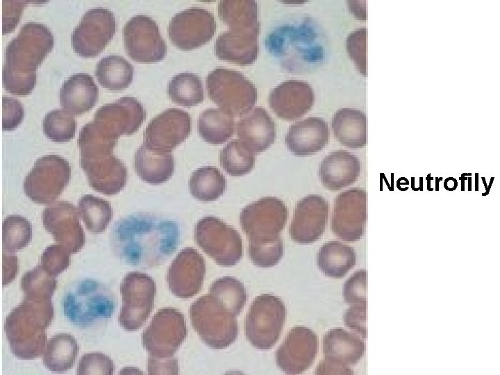 Neutrofily 