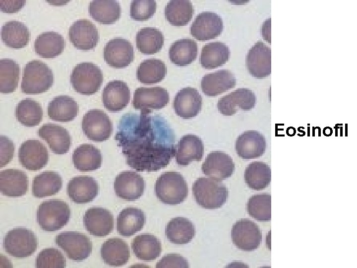 Eosinofil 