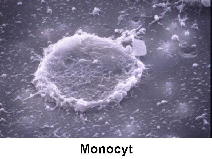Monocyt 