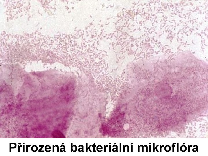 Přirozená bakteriální mikroflóra 