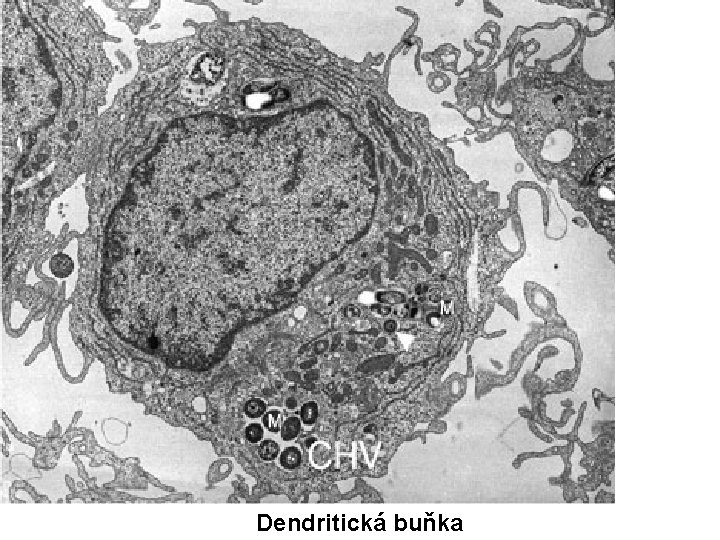 Dendritická buňka 