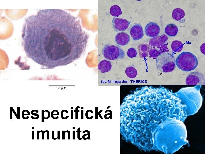 Nespecifická imunita 