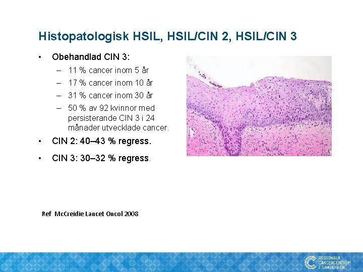 Histopatologisk HSIL, HSIL/CIN 2, HSIL/CIN 3 • Obehandlad CIN 3: – 11 % cancer