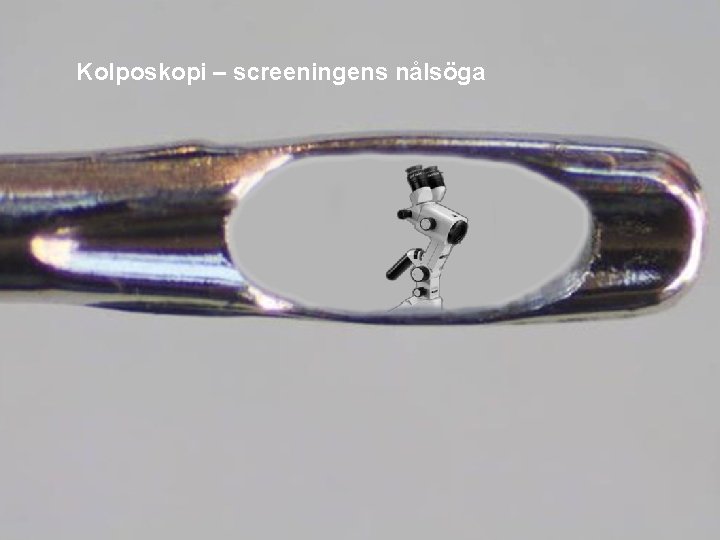 Kolposkopi – screeningens nålsöga 