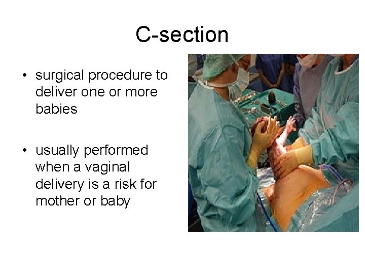 C-section • surgical procedure to deliver one or more babies • usually performed when