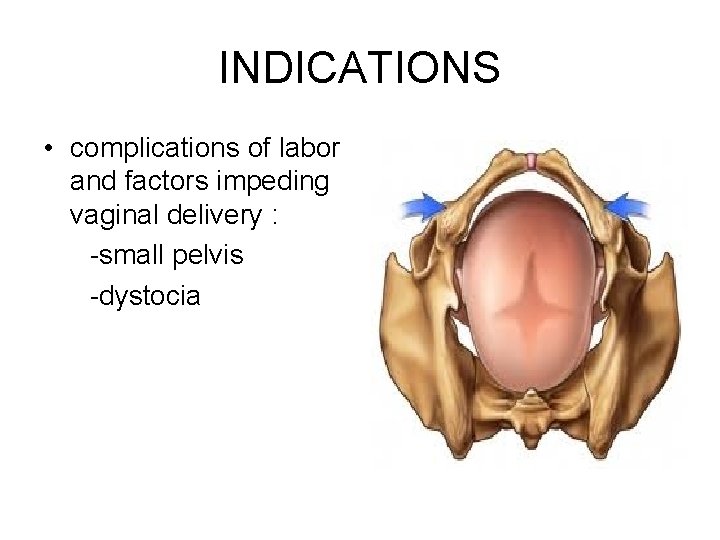 INDICATIONS • complications of labor and factors impeding vaginal delivery : -small pelvis -dystocia