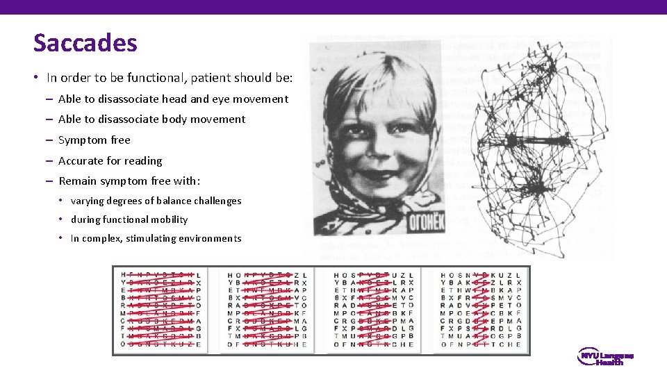 Saccades • In order to be functional, patient should be: – Able to disassociate