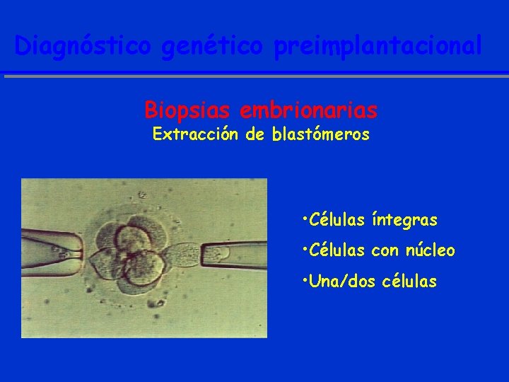 Diagnóstico genético preimplantacional Biopsias embrionarias Extracción de blastómeros • Células íntegras • Células con