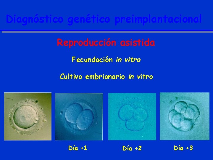 Diagnóstico genético preimplantacional Reproducción asistida Fecundación in vitro Cultivo embrionario in vitro Día +1