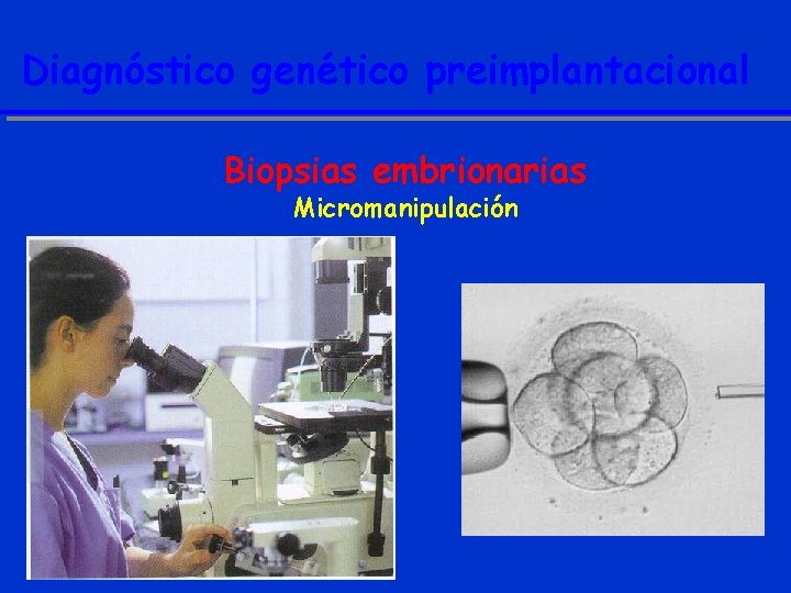 Diagnóstico genético preimplantacional Biopsias embrionarias Micromanipulación 