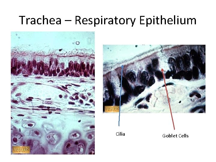 Trachea – Respiratory Epithelium Cilia Goblet Cells 