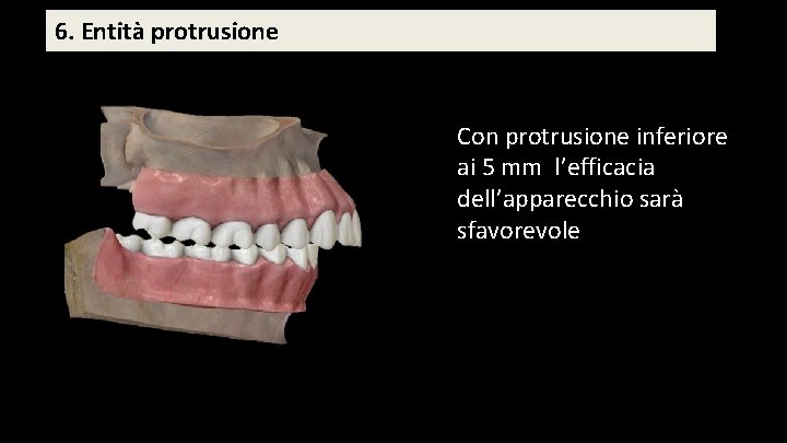 6. Entità protrusione Con protrusione inferiore ai 5 mm l’efficacia dell’apparecchio sarà sfavorevole 6. Entità protrusione Con protrusione inferiore ai 5 mm l’efficacia dell’apparecchio sarà sfavorevole
