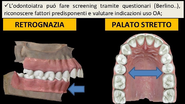 üL’odontoiatra puó fare screening tramite questionari (Berlino. . ), riconoscere fattori predisponenti e valutare üL’odontoiatra puó fare screening tramite questionari (Berlino. . ), riconoscere fattori predisponenti e valutare