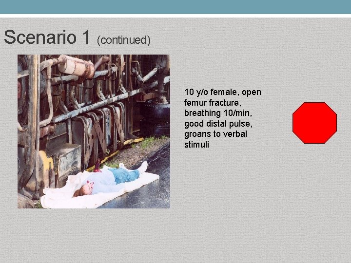 Scenario 1 (continued) 10 y/o female, open femur fracture, breathing 10/min, good distal pulse,