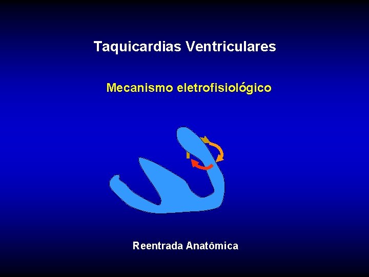 Taquicardias Ventriculares Mecanismo eletrofisiológico Reentrada Anatômica Taquicardias Ventriculares Mecanismo eletrofisiológico Reentrada Anatômica