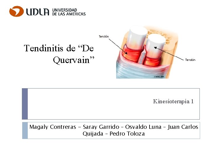 Tendinitis de “De Quervain” Kinesioterapia 1 Magaly Contreras - Saray Garrido – Osvaldo Luna