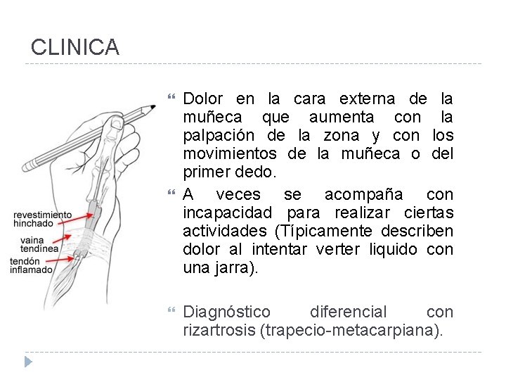 CLINICA Dolor en la cara externa de la muñeca que aumenta con la palpación
