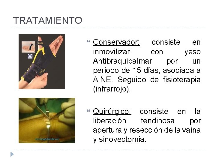TRATAMIENTO Conservador: consiste en inmovilizar con yeso Antibraquipalmar por un periodo de 15 días,