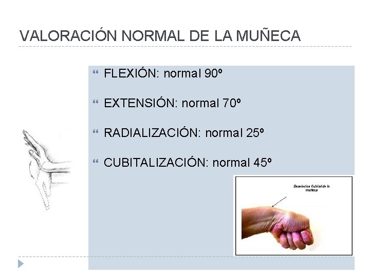 VALORACIÓN NORMAL DE LA MUÑECA FLEXIÓN: normal 90º EXTENSIÓN: normal 70º RADIALIZACIÓN: normal 25º