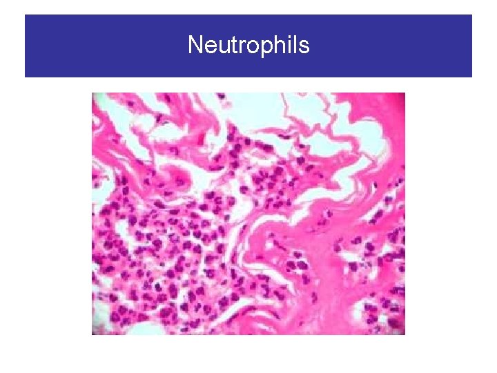 Neutrophils 