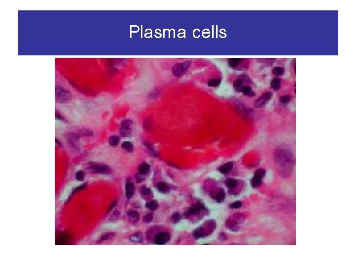 Plasma cells 