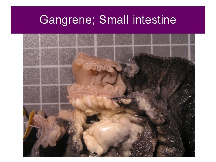 Gangrene; Small intestine 