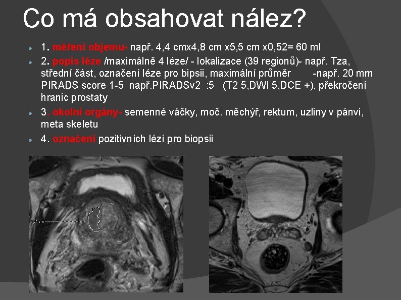 Co má obsahovat nález? 1. měření objemu- např. 4, 4 cmx 4, 8 cm