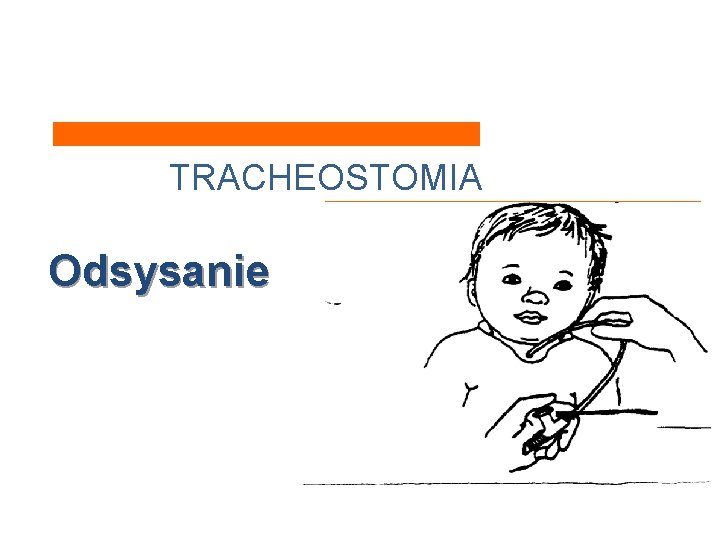 TRACHEOSTOMIA Odsysanie 