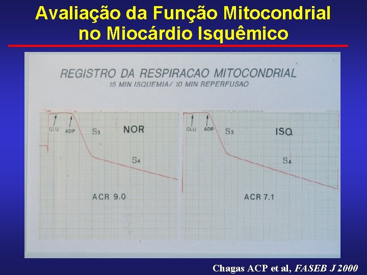 Avaliação da Função Mitocondrial no Miocárdio Isquêmico Chagas ACP et al, FASEB J 2000