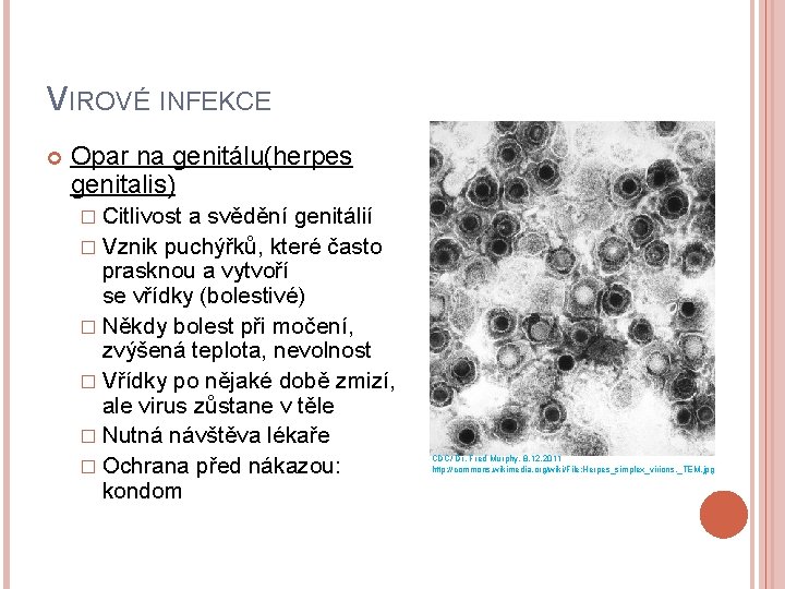 VIROVÉ INFEKCE Opar na genitálu(herpes genitalis) � Citlivost a svědění genitálií � Vznik puchýřků,