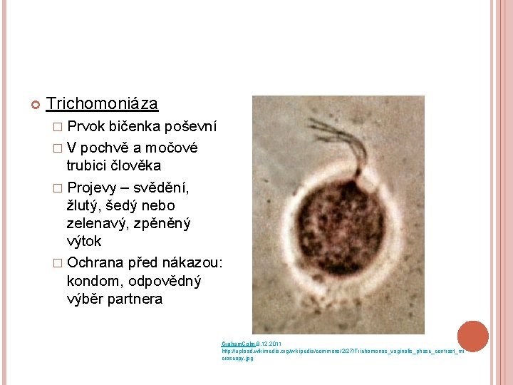  Trichomoniáza � Prvok bičenka poševní � V pochvě a močové trubici člověka �