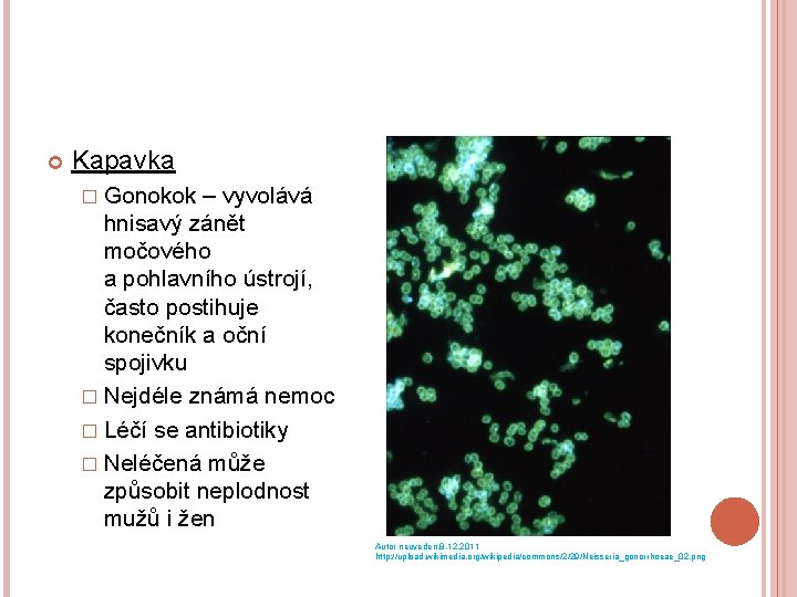  Kapavka � Gonokok – vyvolává hnisavý zánět močového a pohlavního ústrojí, často postihuje