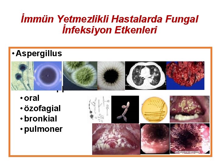 İmmün Yetmezlikli Hastalarda Fungal İnfeksiyon Etkenleri • Aspergillus • Candida spp • oral •