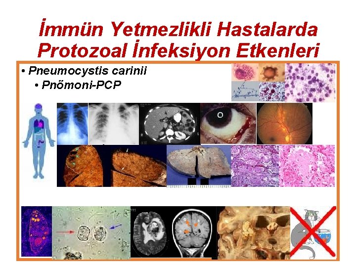 İmmün Yetmezlikli Hastalarda Protozoal İnfeksiyon Etkenleri • Pneumocystis carinii • Pnömoni-PCP • Toxoplasma gondii