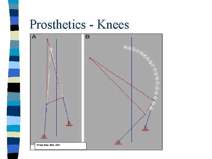 Prosthetics - Knees Picture from Stark, 2004 