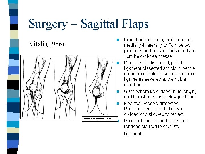 Surgery – Sagittal Flaps n Vitali (1986) n n n Picture from Pinzur et