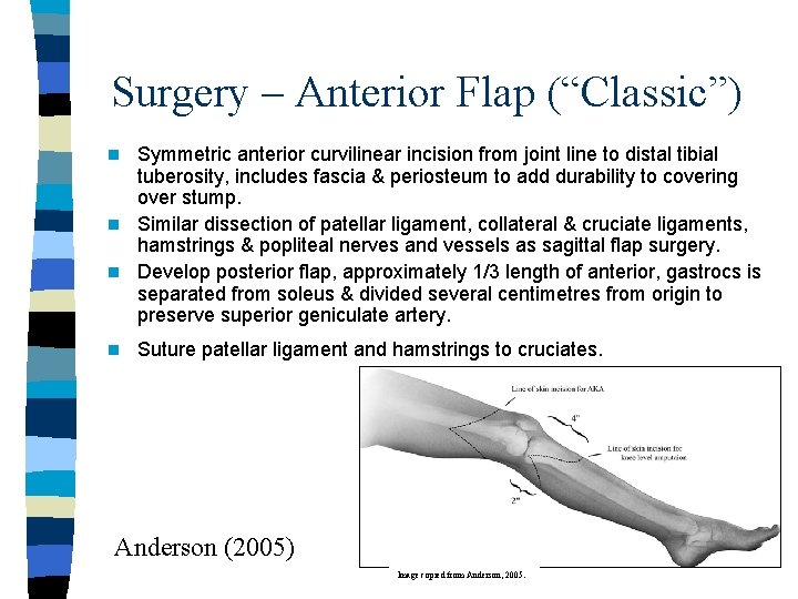 Surgery – Anterior Flap (“Classic”) Symmetric anterior curvilinear incision from joint line to distal