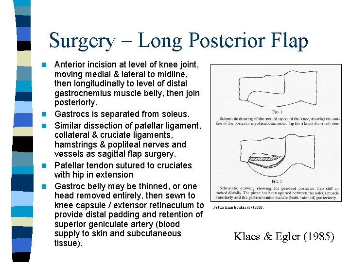 Surgery – Long Posterior Flap n n n Anterior incision at level of knee