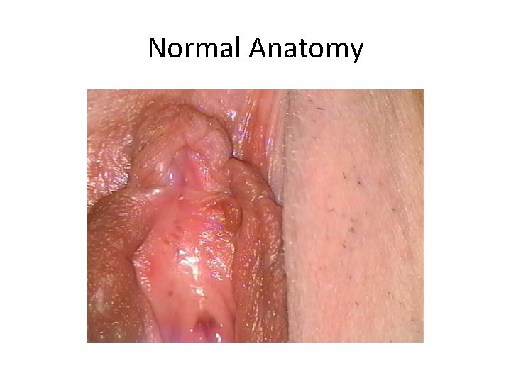 Normal Anatomy 