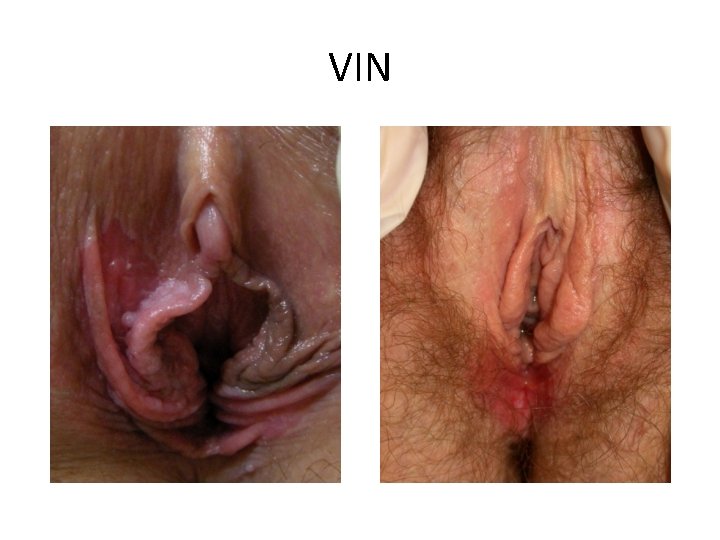 VIN 
